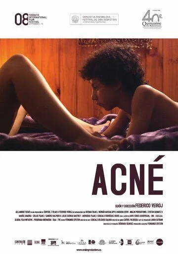 Угри / Acné (2008) фильм скачать через торрент в хорошем качестве